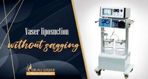 Read more about the article Vaser liposuction to tighten the body without sagging