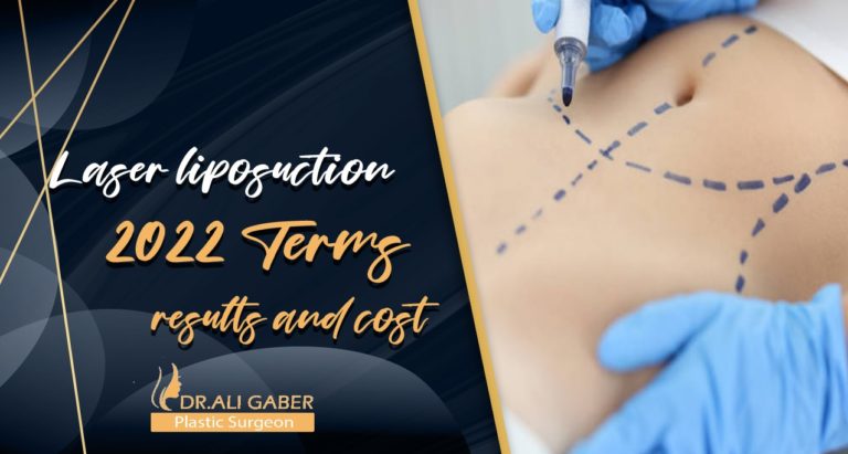 Read more about the article Laser liposuction 2022 Terms, results and cost.
