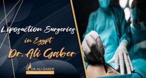 Read more about the article Liposuction Surgeries in Egypt | Dr. Ali Gaber