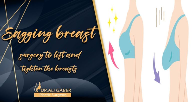 Read more about the article Sagging breast surgery to lift and tighten the breasts