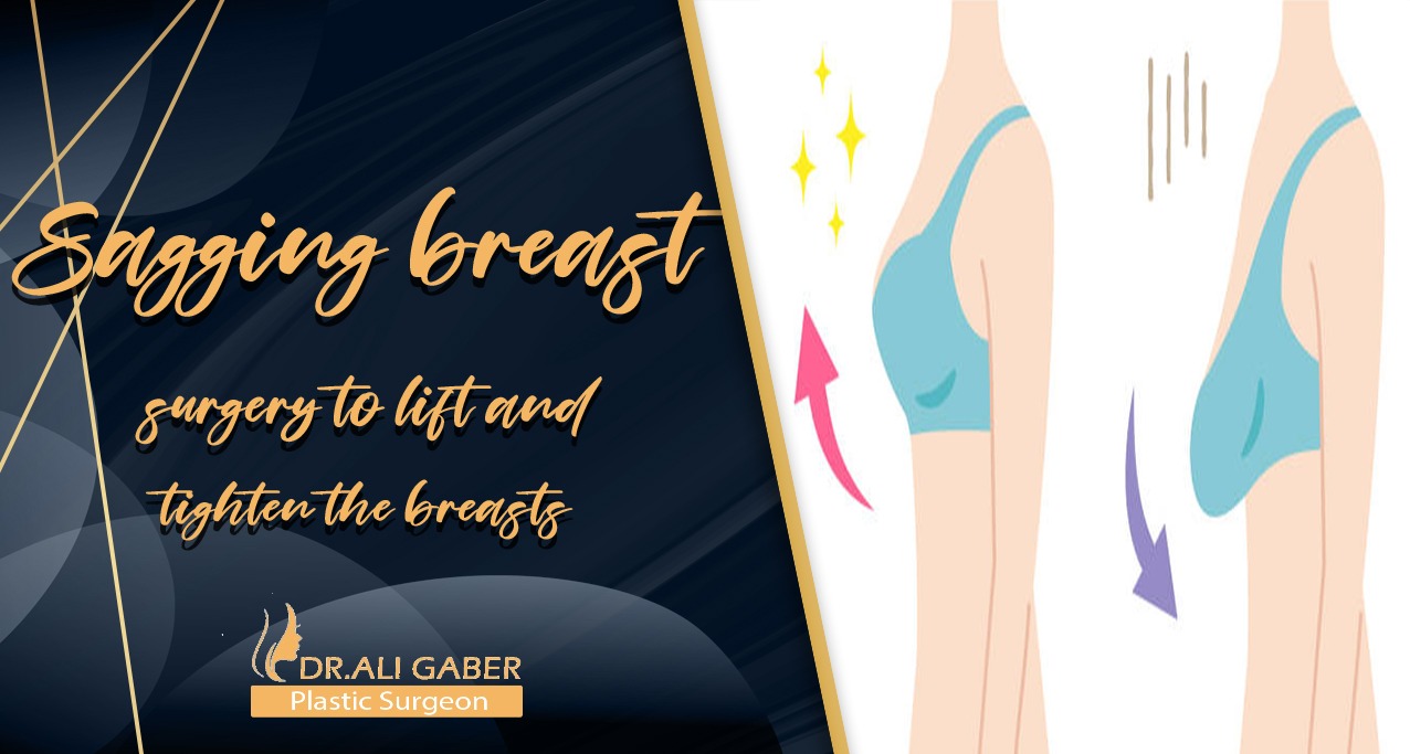 You are currently viewing Sagging breast surgery to lift and tighten the breasts
