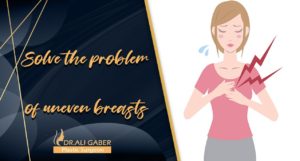 Read more about the article Solve the problem of uneven breasts