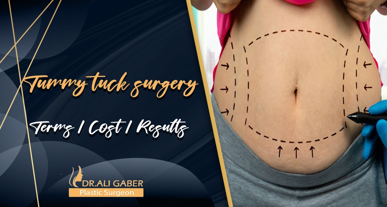 You are currently viewing Tummy tuck surgery in Egypt | Terms | Cost | Results