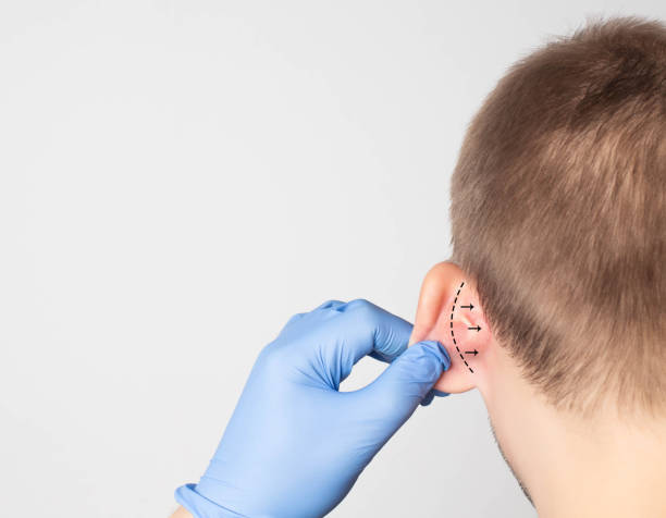 Ear plastic surgery