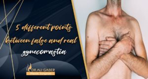 Read more about the article 5 different points between false and real gynecomastia