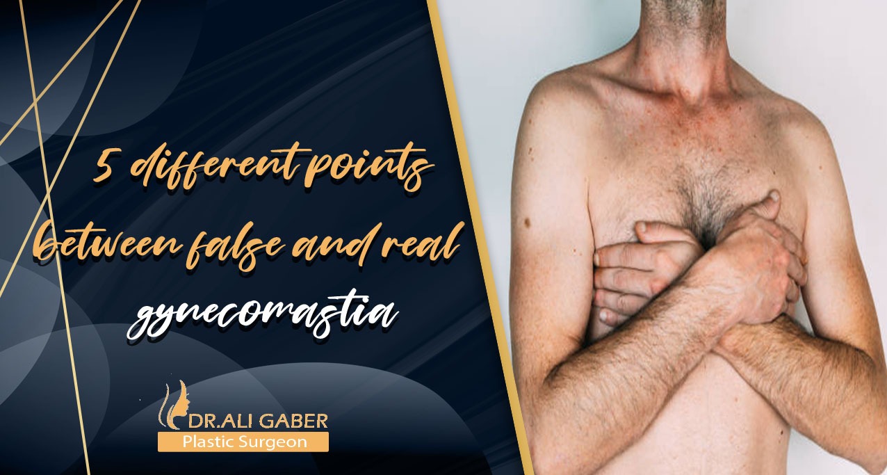 You are currently viewing 5 different points between false and real gynecomastia