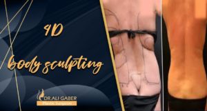 Read more about the article 4D body sculpting