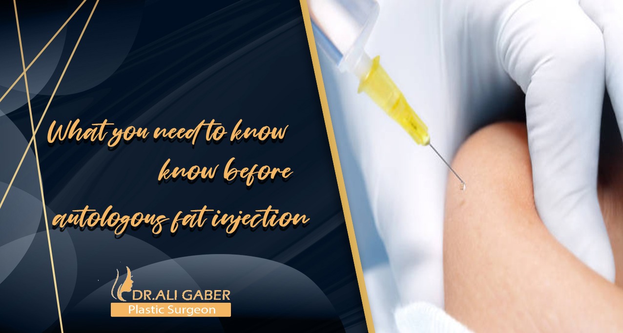 You are currently viewing What you need to know before autologous fat injection.
