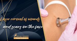Read more about the article Laser removal of wounds and scars on the face