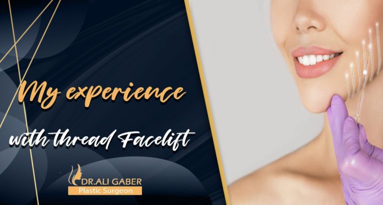 Read more about the article My experience with thread Facelift