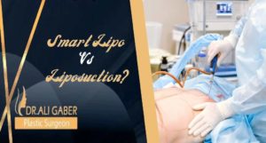 Read more about the article Difference Between Smart Lipo and Liposuction?