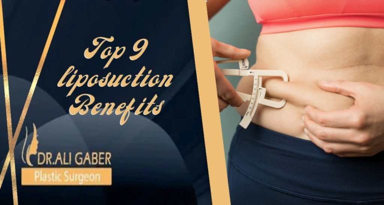 Read more about the article Top 9 Liposuction Great Benefits