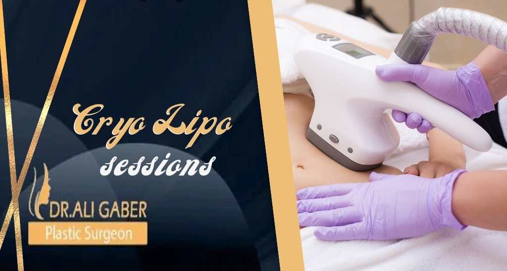 You are currently viewing How many cryo lipo sessions are needed?