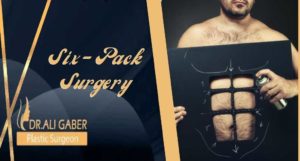 Read more about the article Get Six Pack surgery Abs after Abdominal Etching