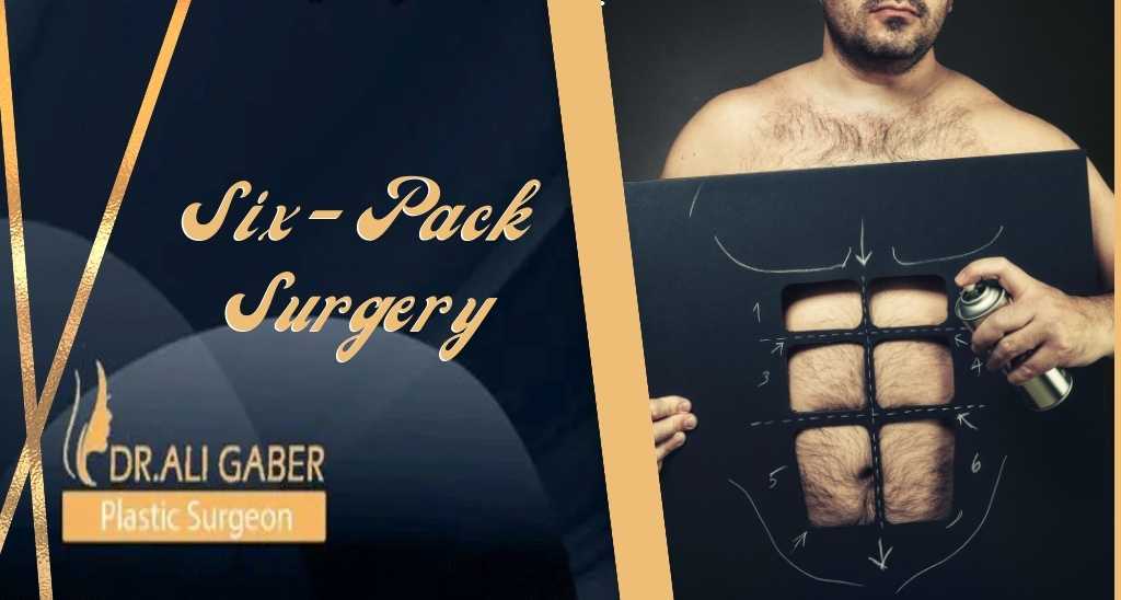 You are currently viewing Get Six Pack surgery Abs after Abdominal Etching