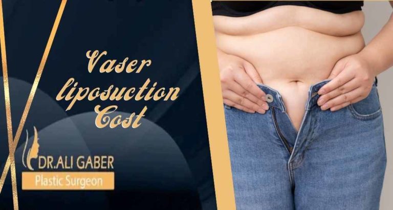 Read more about the article How much does vaser liposuction cost in Egypt