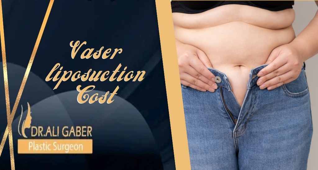 You are currently viewing How much does vaser liposuction cost in Egypt