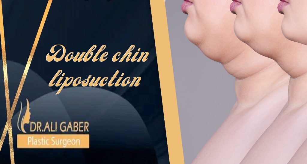 You are currently viewing Double chin liposuction surgery procedure and recovery