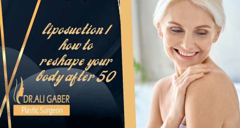 Read more about the article liposuction | how to reshape your body after 50