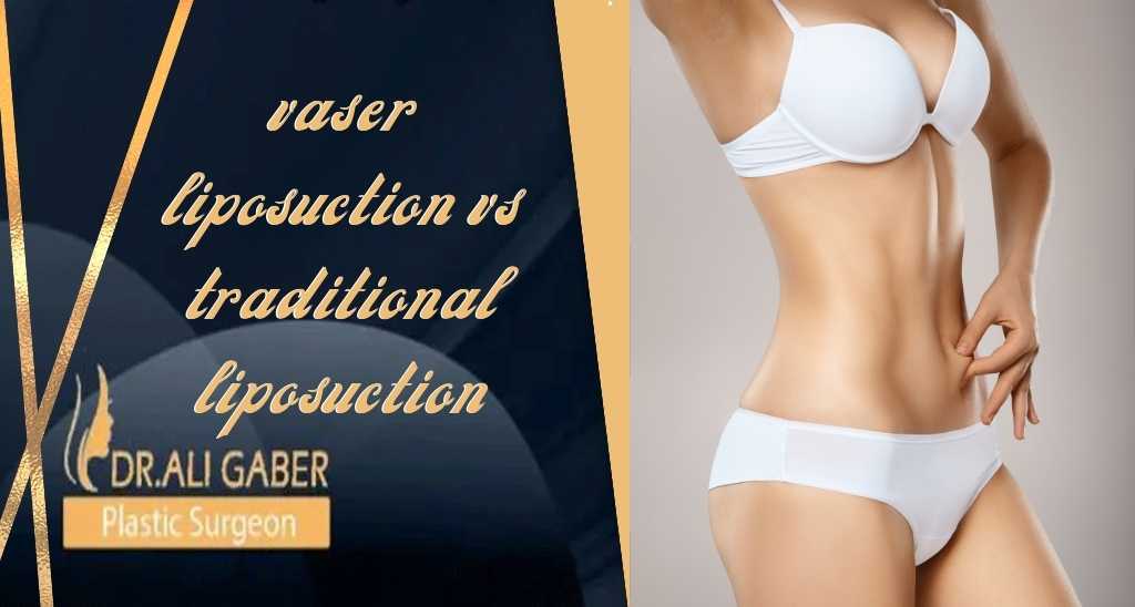 vaser liposuction vs traditional liposuction