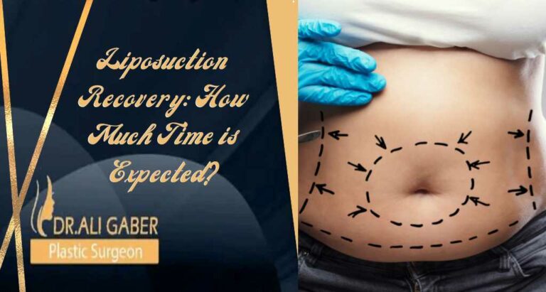 Read more about the article Liposuction Recovery | The expected time