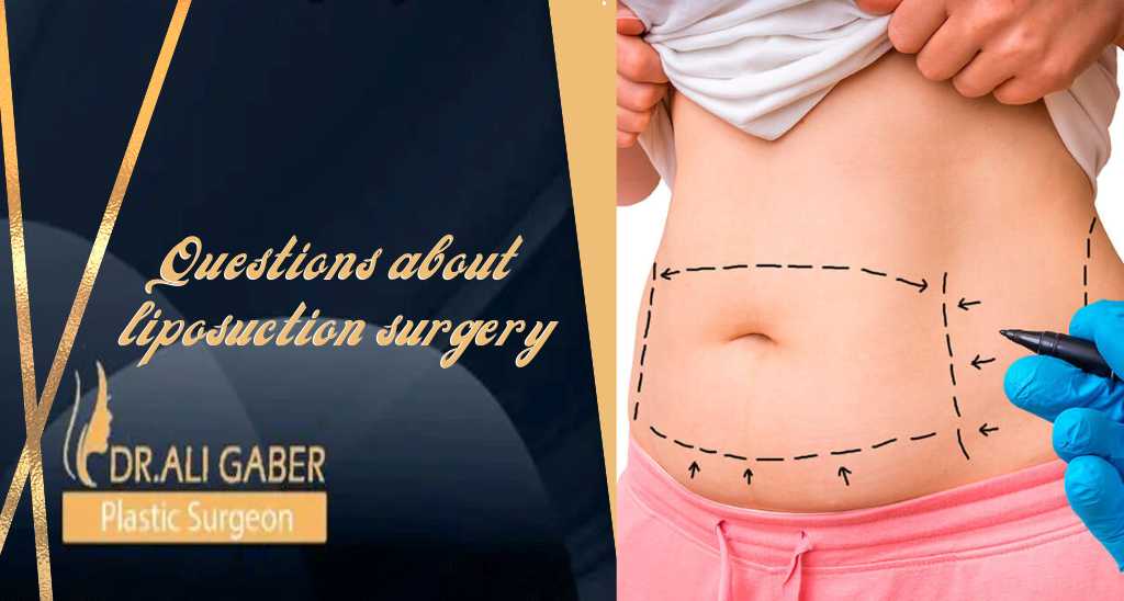 Questions about liposuction surgery