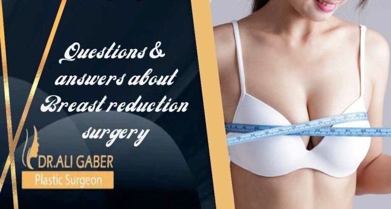 Read more about the article Questions & answers about Breast reduction surgery
