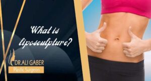 Read more about the article What is liposculpture?