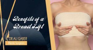 Read more about the article Benefits of a Breast Lift