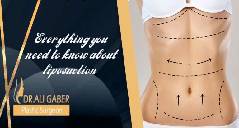 Read more about the article Everything you need to know about liposuction
