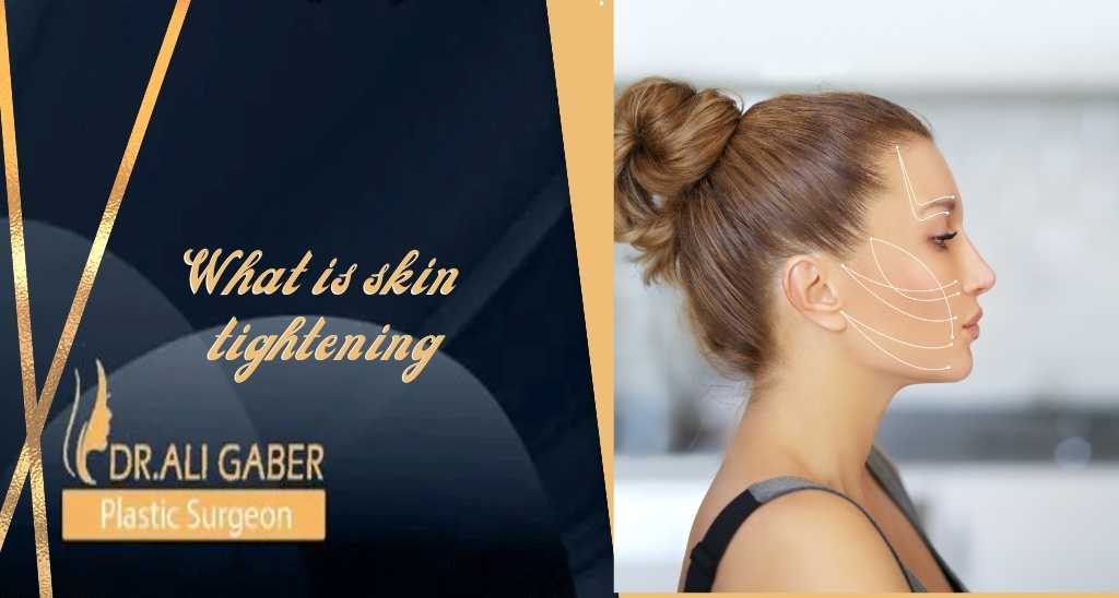What is Skin Tightening?