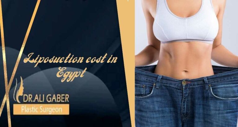 Read more about the article Liposuction cost in Egypt