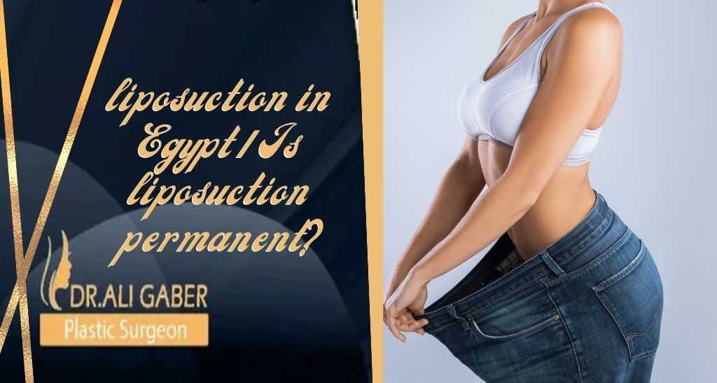 You are currently viewing Liposuction in Egypt: is liposuction permanent?
