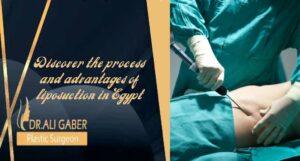 Read more about the article Discover The Process and Advantages Of Liposuction in Egypt
