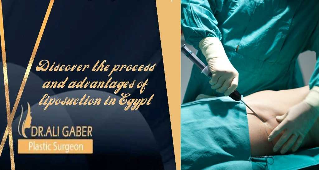 You are currently viewing Discover The Process and Advantages Of Liposuction in Egypt