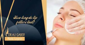 Read more about the article How long do lip fillers last?