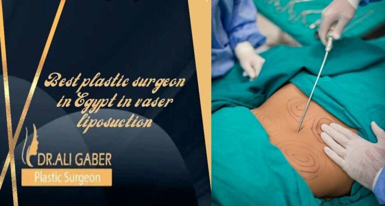 Read more about the article Best plastic surgeon in Egypt in Vaser Liposuction