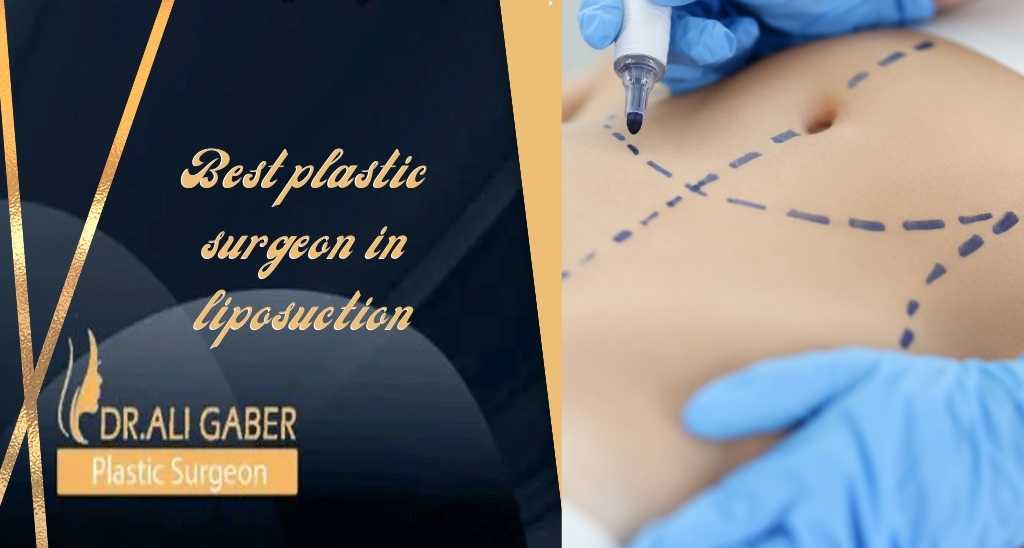 You are currently viewing Best Plastic Surgeon In Liposuction