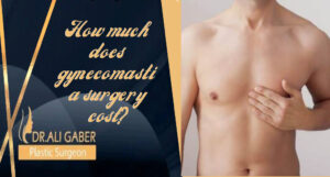 Read more about the article How much does gynecomastia surgery cost