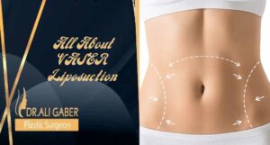Read more about the article All About VASER Liposuction