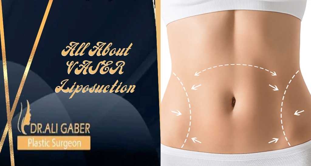 You are currently viewing All About VASER Liposuction
