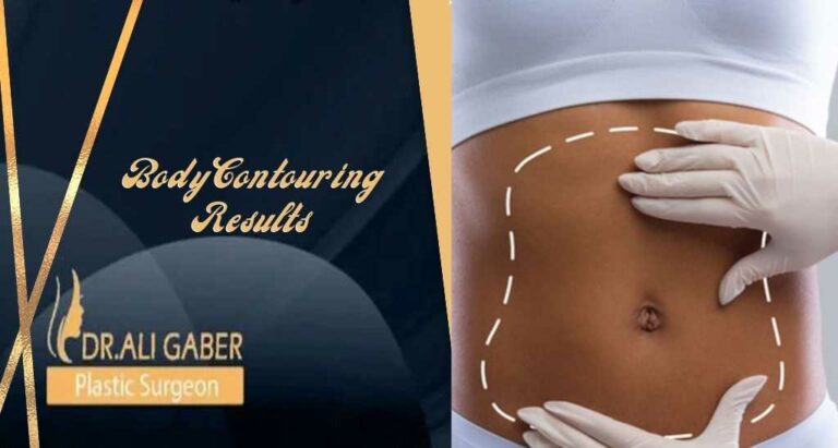 Read more about the article Body Contouring Results