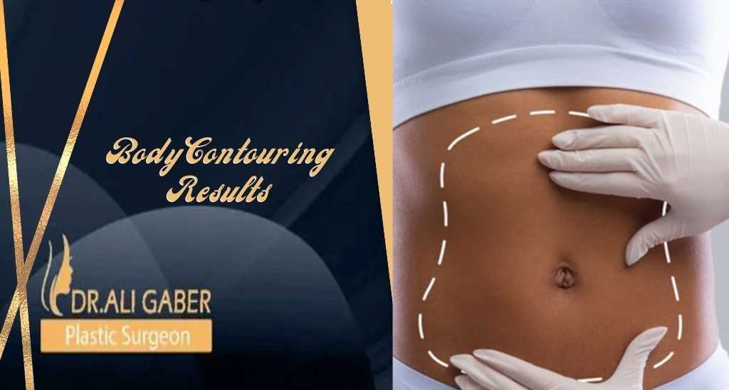 You are currently viewing Body Contouring Results
