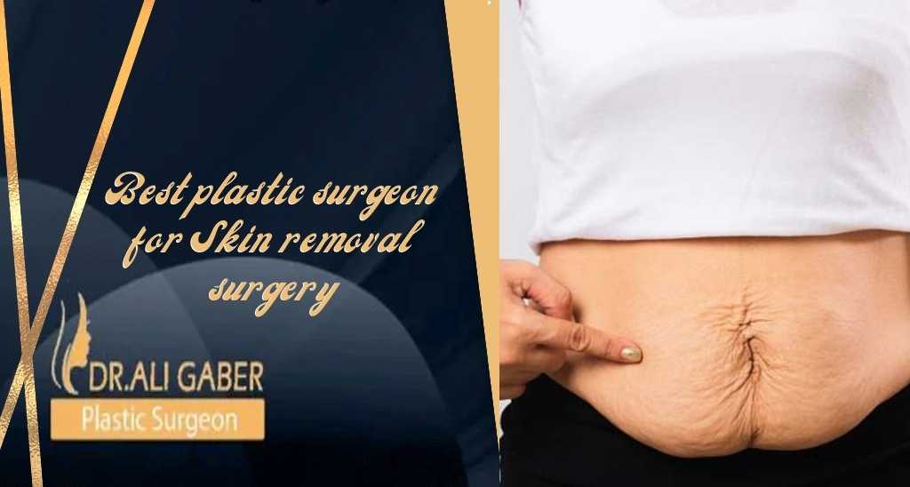 You are currently viewing Best Plastic Surgeon For Skin Removal Surgery