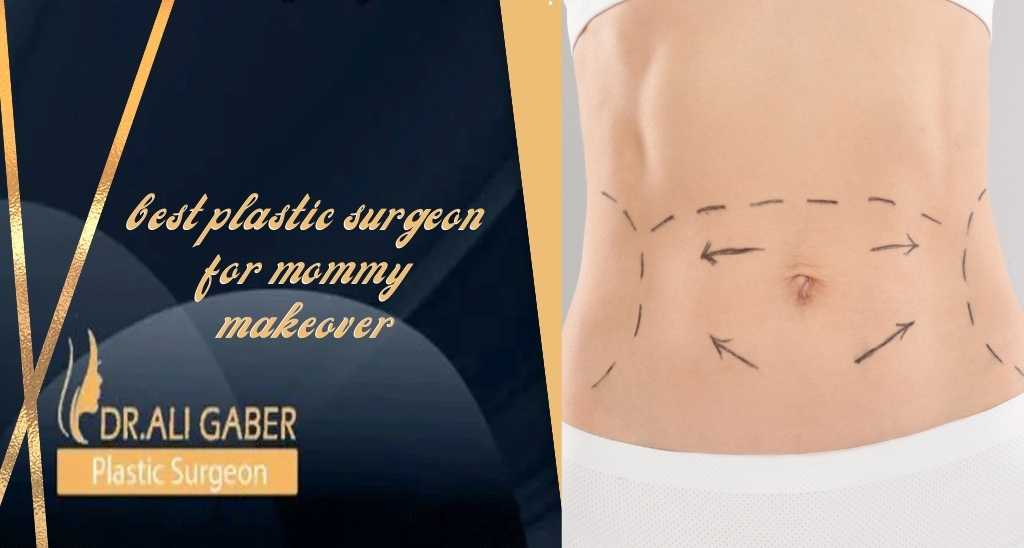 You are currently viewing Best plastic surgeon for mommy makeover