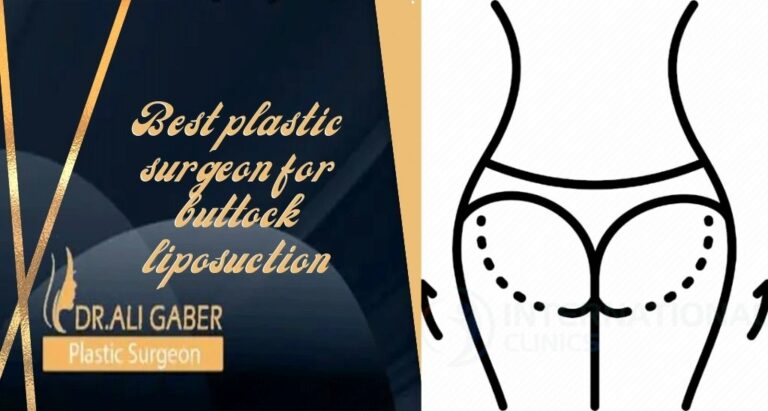 Read more about the article Best plastic surgeon for buttock liposuction