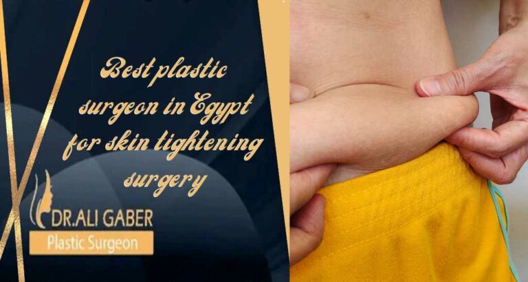 Read more about the article Best plastic surgeon in Egypt for skin tightening surgery