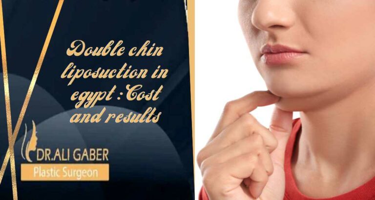 Read more about the article Double chin liposuction in Egypt: Cost and results
