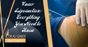 Read more about the article Vaser Liposuction: Everything You Need to Know